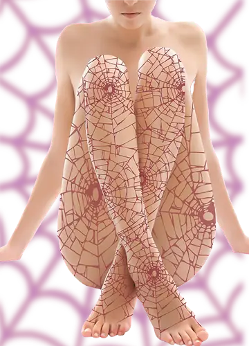 Imagen ilustrativa de Spider